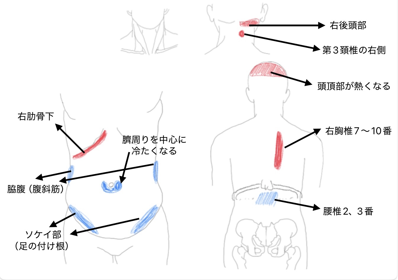 眼精疲労と骨盤の関係