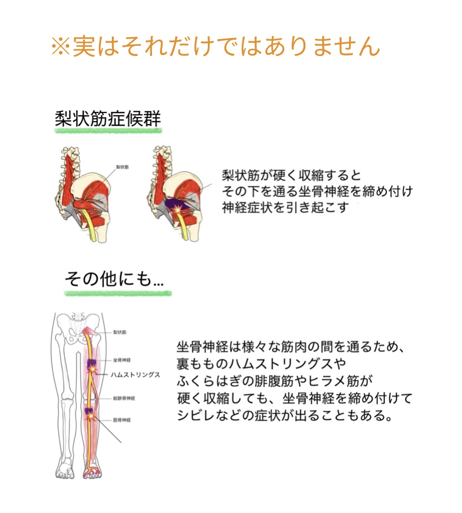 画像診断と症状の違い
