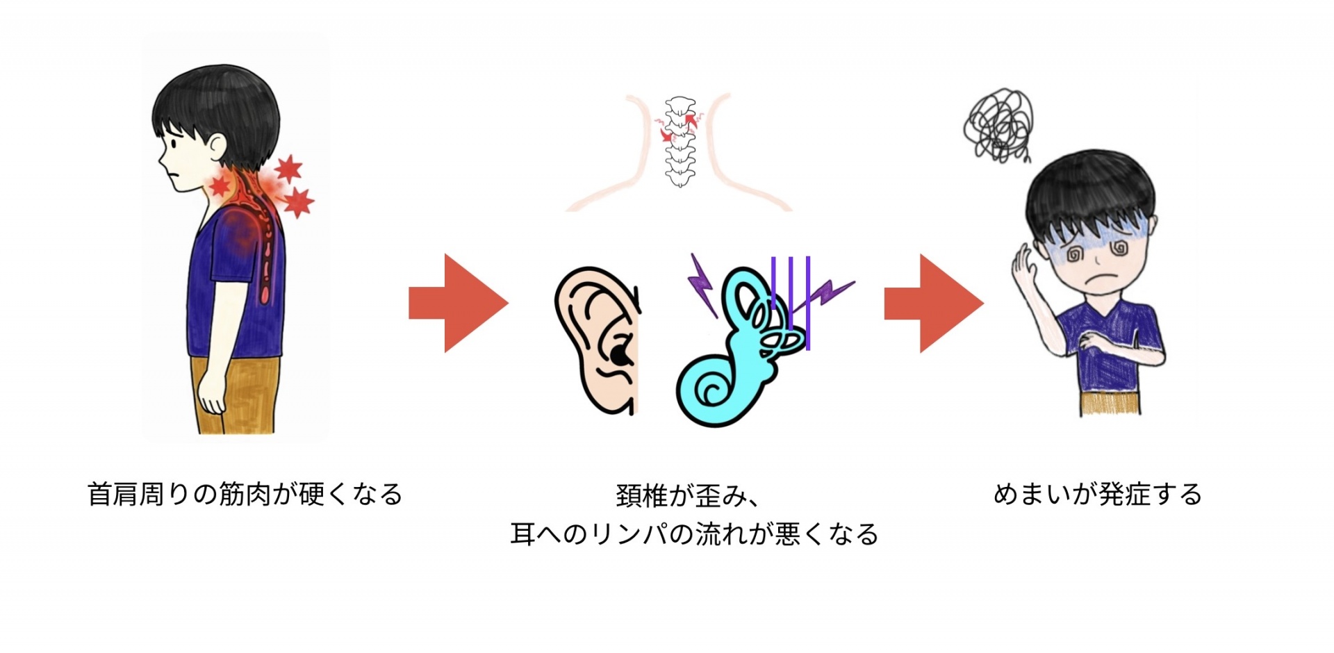めまいの原因イメージ