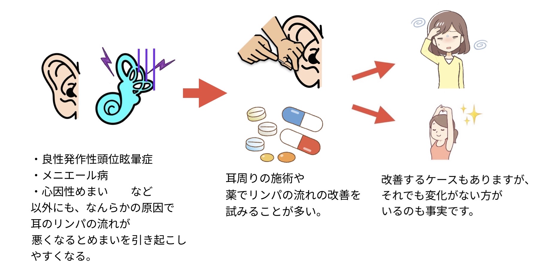 めまいの原因イメージ